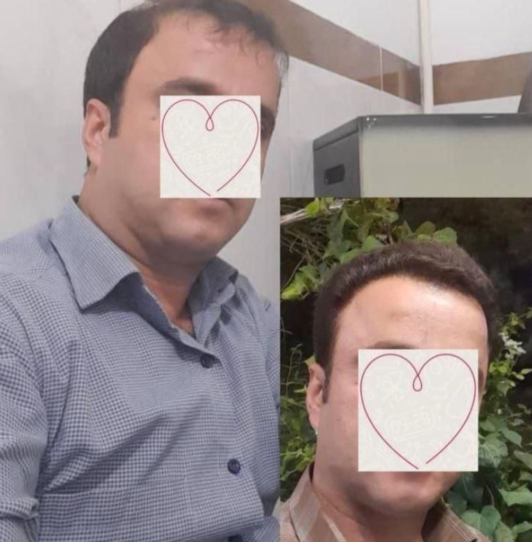 جشنواره کاشت مو، ابرو، ریش حرفه‌ای پرتراکم و طبیعی در قدوسی غربی شیراز - مو